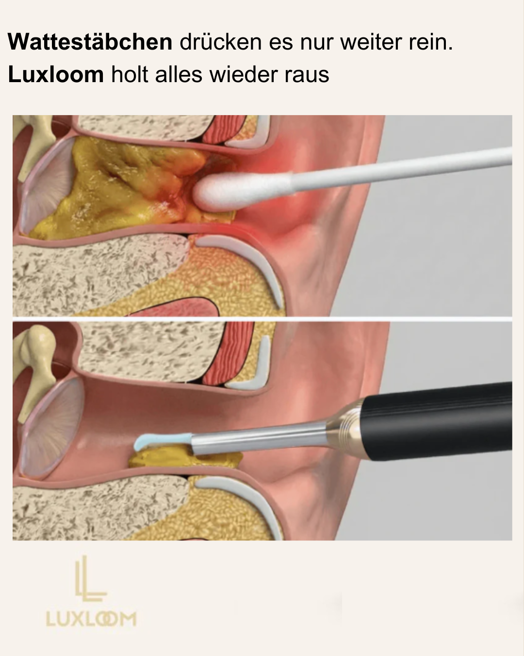 Luxloom - Ohrenreiniger mit HD-Kamera